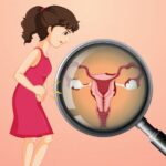 கர்ப்பப்பையை எடுக்காதீங்க