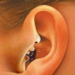 காதுக்குள் அலை ஓசை, விசில் சத்தம்…