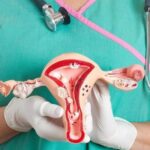 கர்ப்பத்தை தடுக்கும் ஃபைப்ராய்டு கட்டிகள்..!