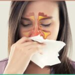 சைனஸ்க்கு ஹோமியோவில் நிரந்தரத் தீர்வு!