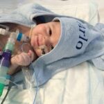 ஆசனவாய் இல்லாத குழந்தைக்கு அறுவை சிகிச்சை